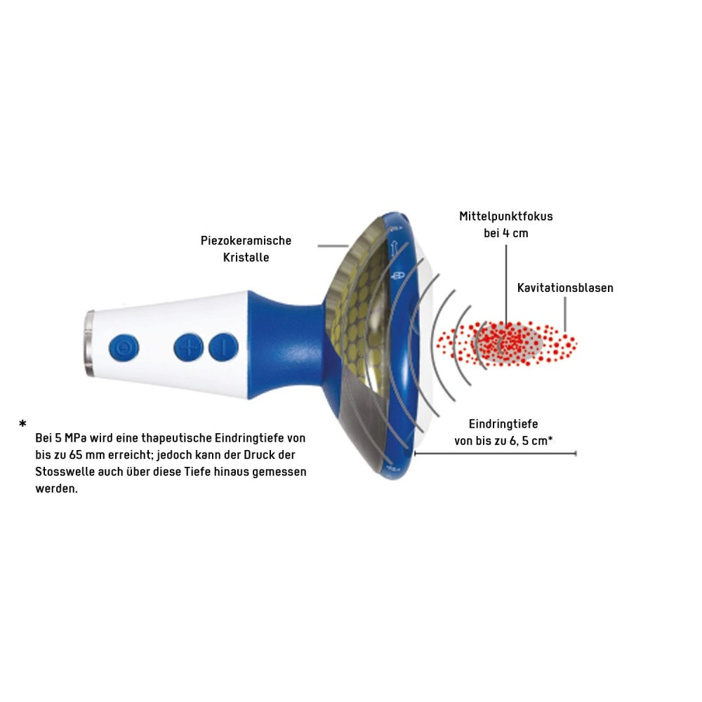 Wirkverfahren des fokussierten Stoßwellengerät DOLORCLAST Focused Shock Waves
